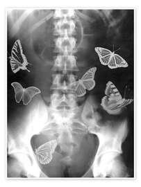 Póster  Butterflies in the stomach - PhotoStock-Israel